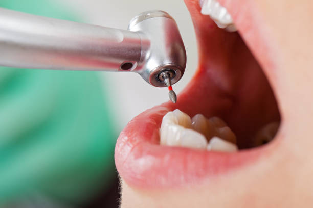 Best Emergency Dentist for Kids  in Berry Creek, CA
